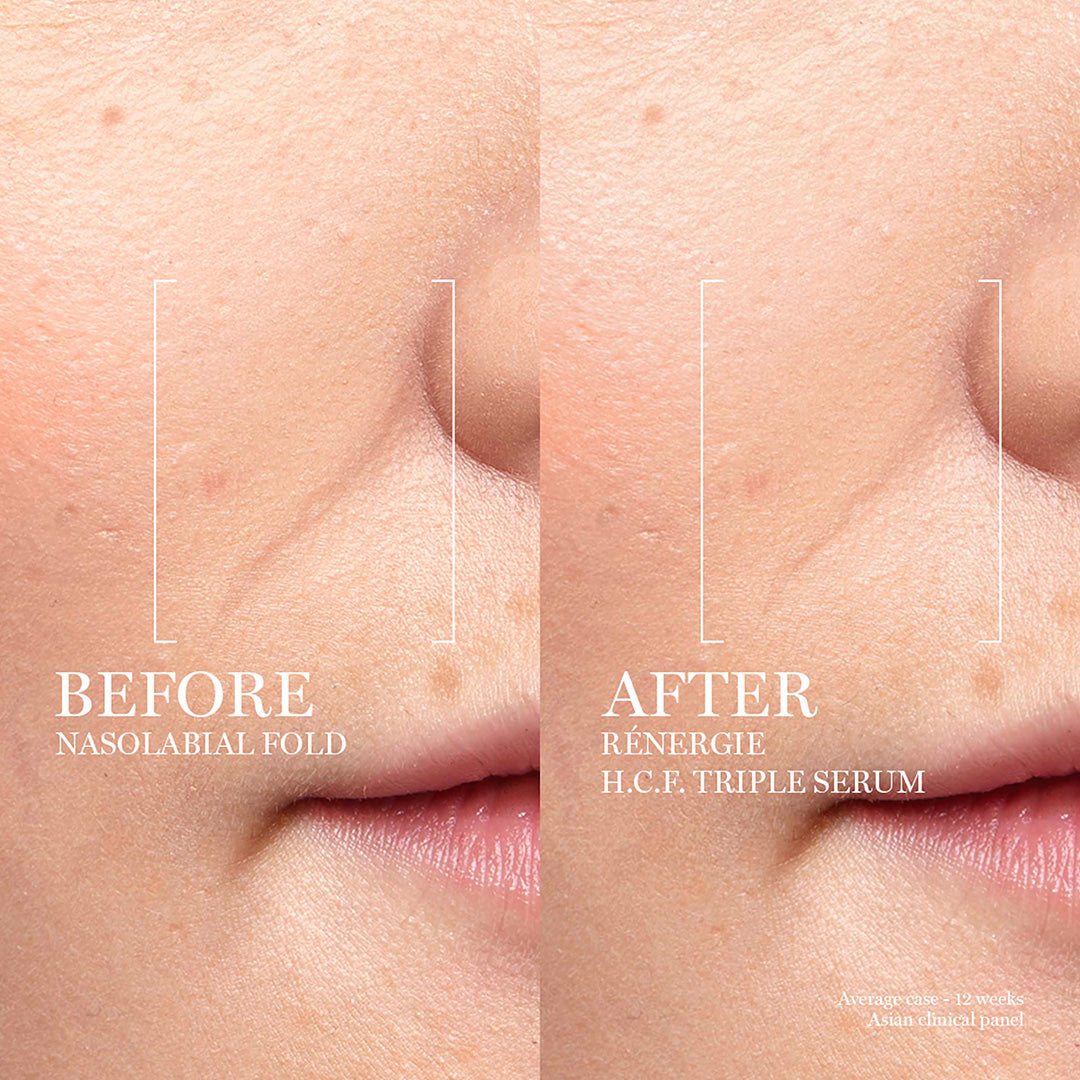 Rénergie H.C.F. Triple Serum 50ml