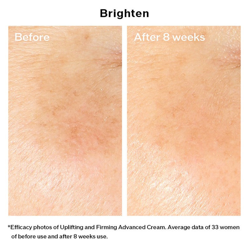 Vital Perfection Uplifting and Firming Advanced Cream 50ml