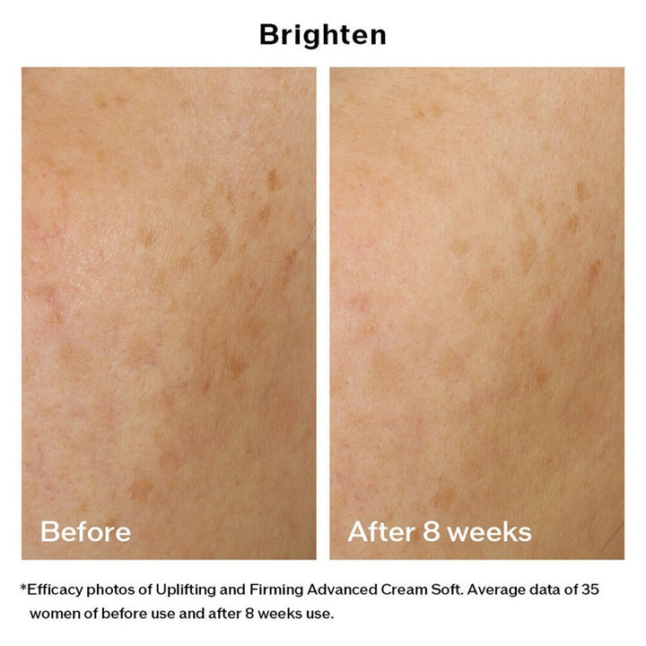 Vital Perfection Uplifting and Firming Advanced Cream Soft 50ml